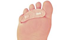 Pedifix Hammer Toe Crest (Buttress Pad)
