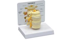 GPI Anatomicals  Basic Vertebrae Model