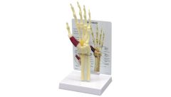 GPI Anatomicals  Wrist/Hand Carpal Tunnel Syndrome Model