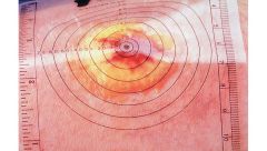 Disposable Wound Measuring Guides