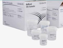 Prefilled Formalin Specimen Container,10% NBF 120 mL,Handi Pack BXTC432060HZ