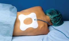ECG Back Pad Electrode, NDM Style with Molex