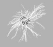 MReye Embolization Coil, Extended Embolus Length 4 cm, 1.59 Loops