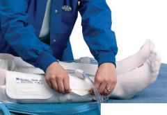 Comfort SCD Sleeve,Thigh-Length,Disposable,Size M COV9530BH