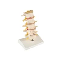 Anatomical Spine Model