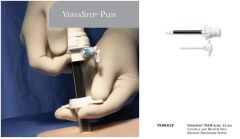 Dilator Cannula,Radially Expandable Sleeve,Long,12 mm