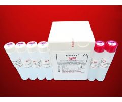 Reagent Kit K-ASSAY Immunochemistry / Specific Protein Test Immunoglobulin