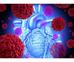 Reagent Cardiac / Lipids / General Chemistry Lipoprotein (a) 1 X 20 mL