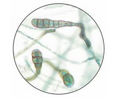 Prepared Microscope Slide Scopulariopsis Species Prepared Slide
