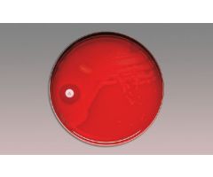Differentiation Disc BBL Taxo P Optochin 5.0 g 17313