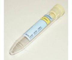 BD Vacutainer Urinalysis Tube Conical Bottom Plain 16 X 100 mm 8 mL Yellow Conventional