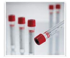 VACUETTE Z Serum Sep Clot Activator Venous Blood Collection Tube Clot Activator / Separator Gel Additive 4 mL Pull Cap Polyethylene Terephthalate (PET) Tube
