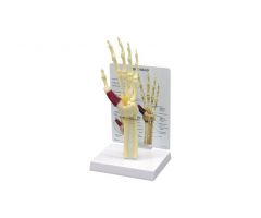 GPI Anatomicals  Wrist/Hand Carpal Tunnel Syndrome Model