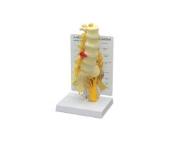 GPI Anatomicals  Lumbar with Sacrum Model