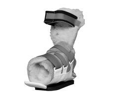 Adjustable Telescoping Foot Splint