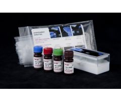 Linearity Kit NOD Hemoglobin A1c (HbA1c) 4 X 1 mL For PTS A1CNow+ and Siemens DCA 2000