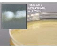Prepared Media Inhibitory Mold Agar with Chloramphenicol Deep Fill Plate Format