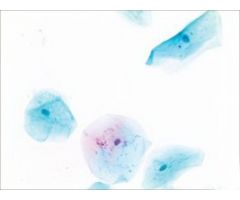 PAPANICOLAOU STAIN 1L