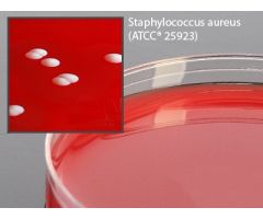Prepared Media Columbia Naladixic Acid (CAN) Agar Red Petri Plate Format 919166