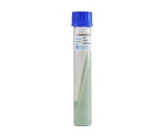 Prepared Media Lowenstein-Jensen Medium Slant Tube Format