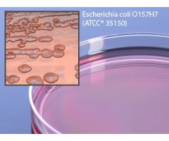 Prepared Media MacConkey Agar with Sorbital Petri Plate Format