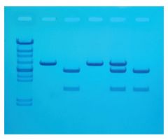 Edvotek Cholesterol Diagnostics Educational Kit 8 gels, Refrigerated