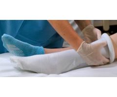 Alba Sterile Stockinette