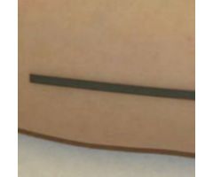 Indicator Radiopaque Ct Skin Marker 1mm