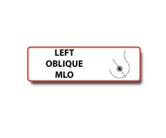 "Left Oblique MLO" Permanent Adhesive Labels. Unlaminated-Red Border, Black Print. 500 per roll. 1/2" H x 1 1/2" W. For use in Mammography