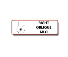 "Right Oblique MLO" Permanent Adhesive Labels. Unlaminated-Red Border, Black Print. 500 per roll. 1/2" H x 1 1/2" W. For use in Mammography.
