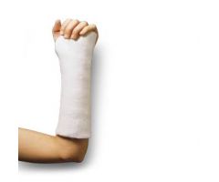 Fiberglass Splint, 3" x 15' Roll
