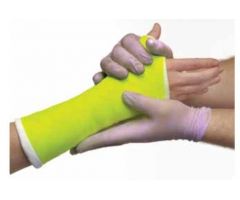 Delta-Lite Conformable Fiberglass Casting Tape, 2" x 4 yd., Green