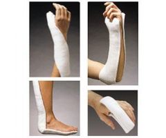 Ortho-Glass Solo Precut Unpadded Splinting System, 4" x 15"