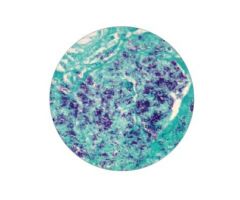 STAIN KIT ACID FAST BACTERIA (AFB)